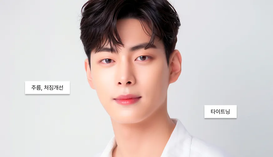 올리지오 리프팅