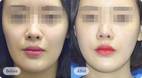 자연스럽게 아름다워지는 리핏의원