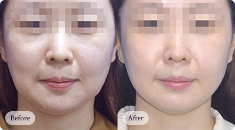 자연스럽게 아름다워지는 리핏의원